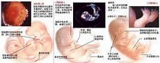 怀孕后一周怎么打胎